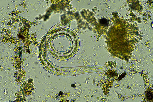 Mikroskopische Aufnahme eines spiralförmigen Nematodenlarve umgeben von Schmutzpartikeln