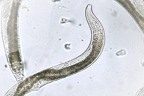 Nahaufnahme von mehreren fadenförmigen Nematoden unter dem Mikroskop
